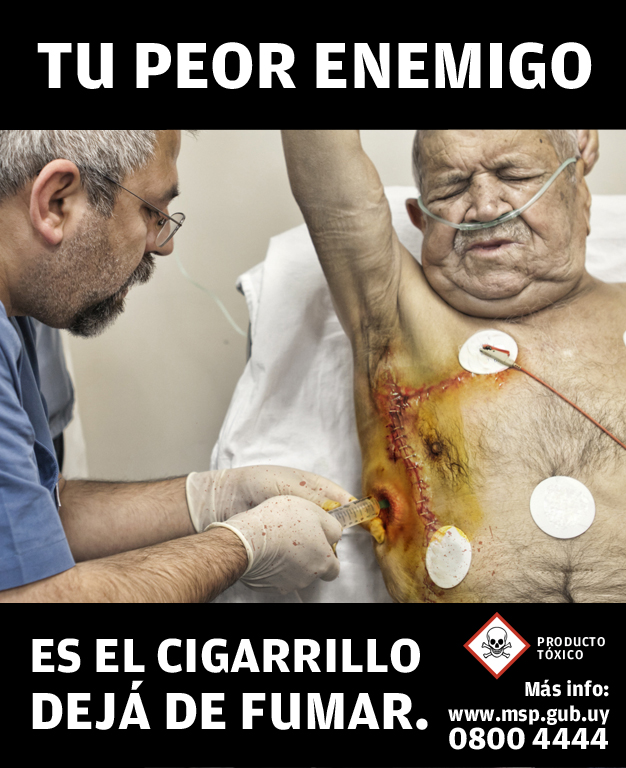 Ha dejado a fumar la cabeza como en la niebla
