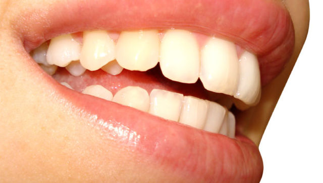 Una cosa lleva a la otra