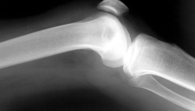 Presuntos implicados