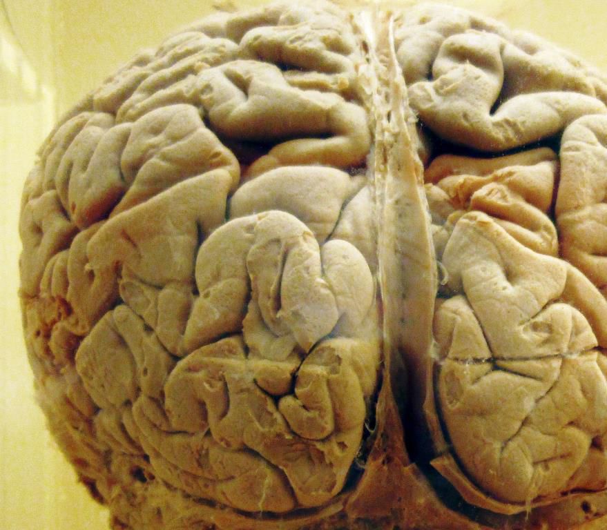 Cerebro, orgasmo