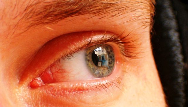 Volver a verte otra vez