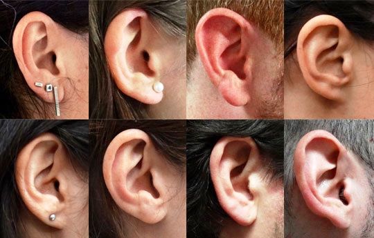 La forma de tus orejas está condicionada genéticamente