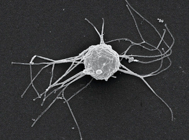 Hay algo que tenemos...