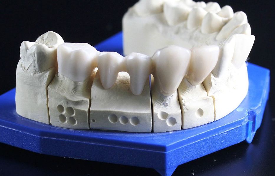 Las mata bien muertas