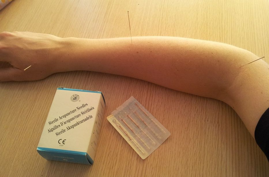 Tirame con las agujas