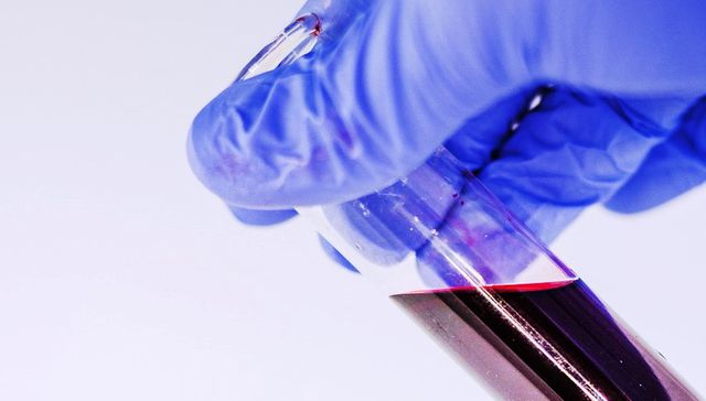 Hacerse buena sangre