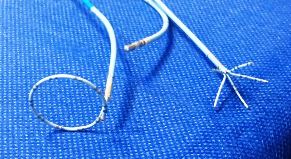 Innovación en el tratamiento de arritmias cardiacas