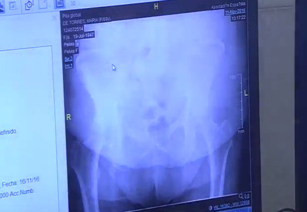 Cómo mueve la cadera