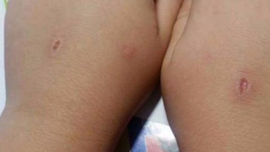 Córtenla con los cortes