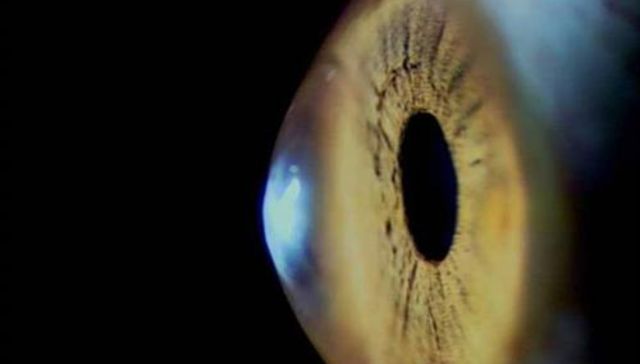 Ensayo sobre la ceguera