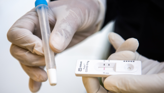 De arriba un hisopado