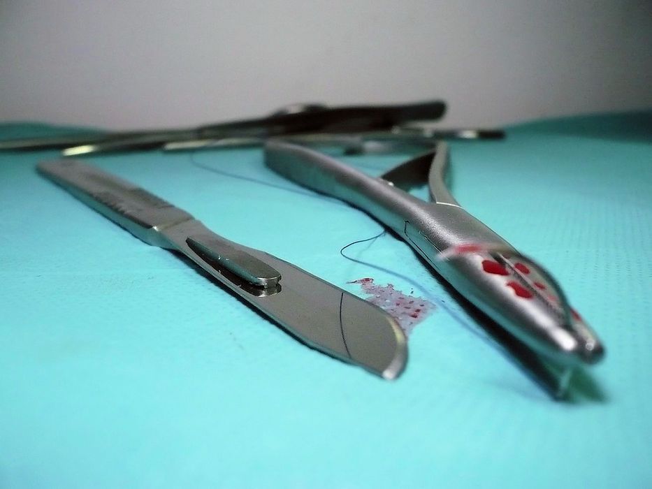 Shenshayba, la aldea afgana donde vivir cuesta -literalmente- un riñón