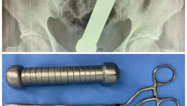 Se sacó un peso de encima