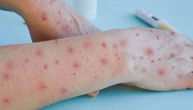 Por The New York Times