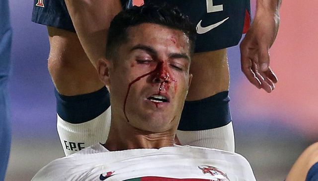 Dejó la sangre