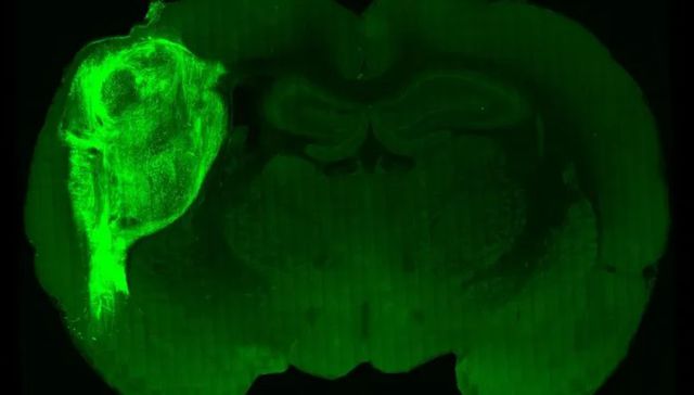 Más despacio, cerebrito