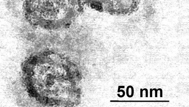 Para saberlo antes y mejor