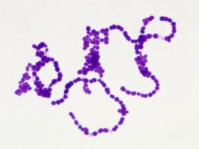Streptococcus pyogenes a través de microscopio. Foto: Twitter @eduregueira