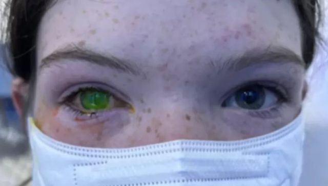 Aquellos ojos verdes