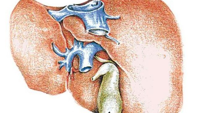 Miedo no: precaución