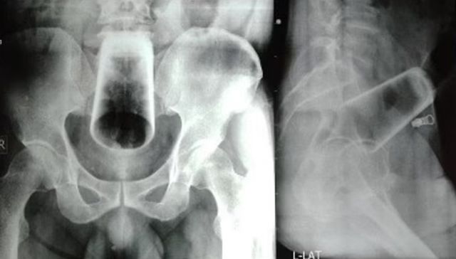 A mí que me revisen