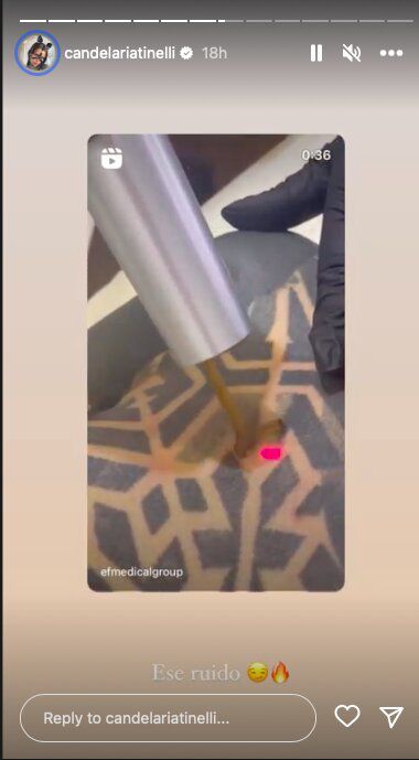 Foto: captura historias de Instagram @candelariatinelli