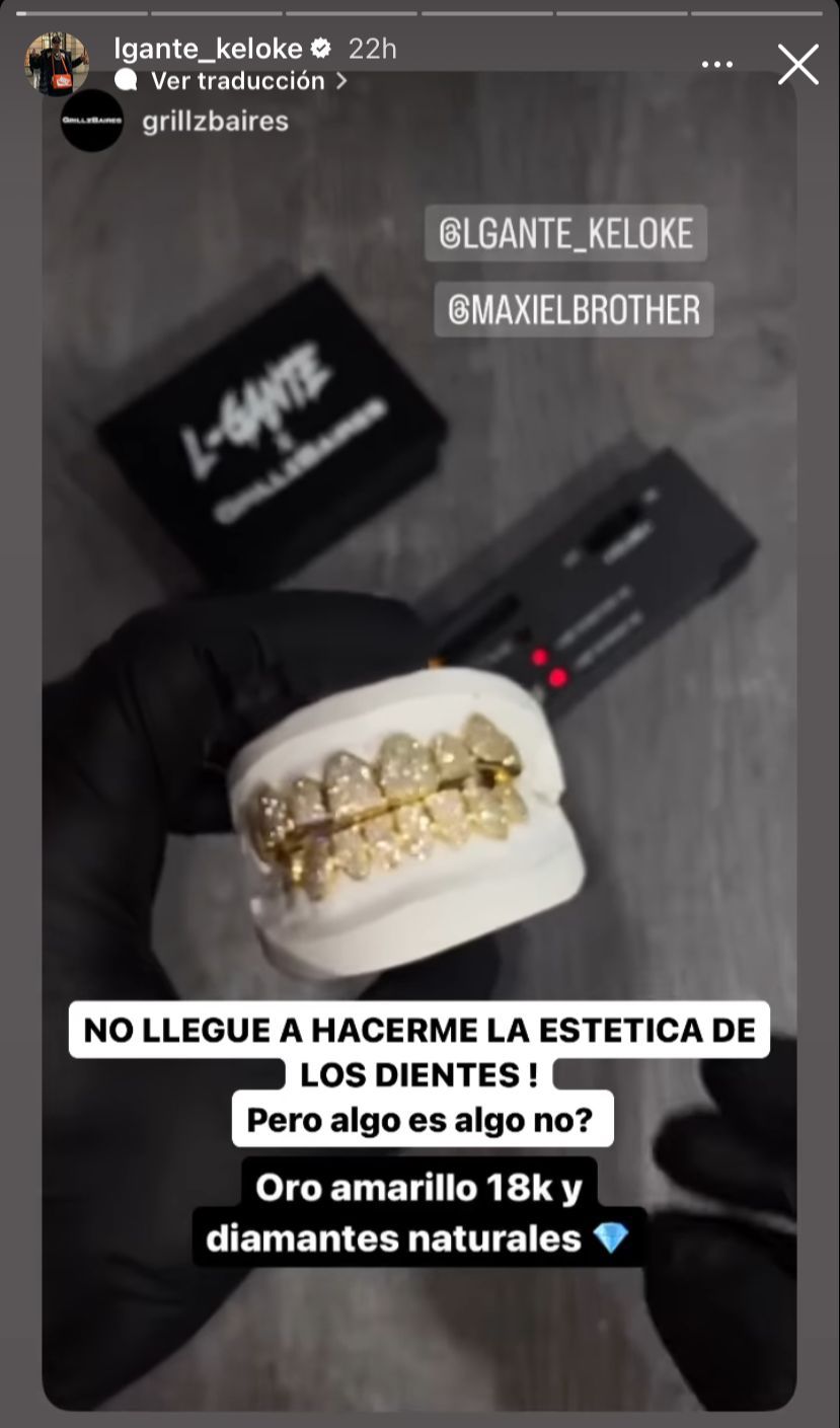 La nueva dentadura postiza de L-Gante. Foto: Instagram / @lgante_keloke