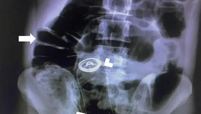 Bis repetita placent