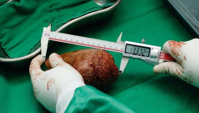 En los cálculos de nadie