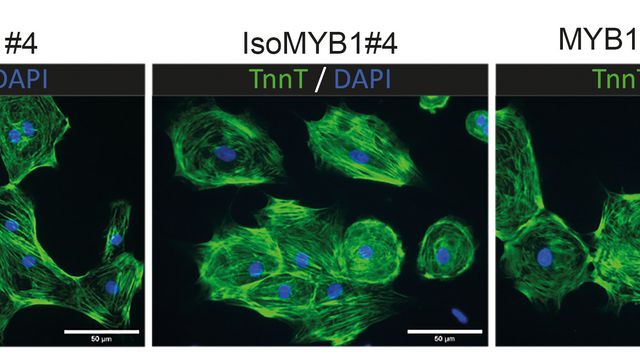 Todos somos diferentes