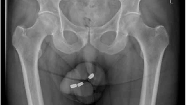Batteries not included