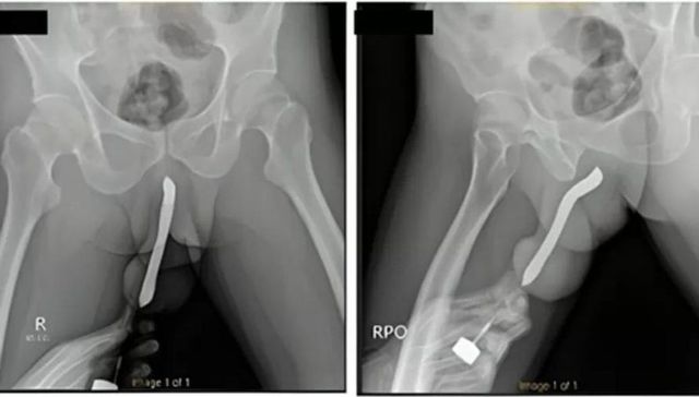 Cuando se abren las cerdas