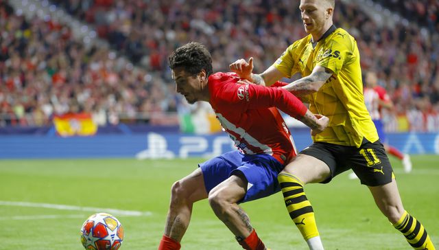 Sin pelos en la lengua