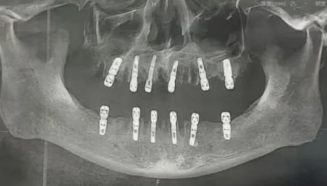 Nuevo temor desbloqueado