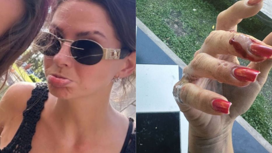 Desgracia con suerte