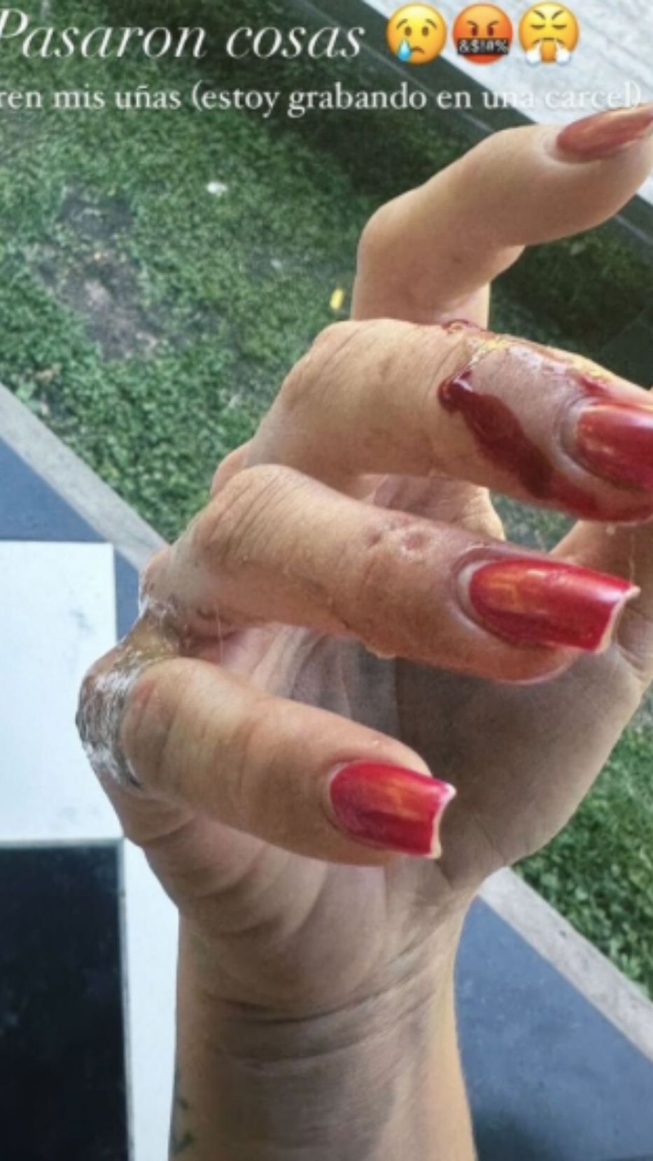 Foto: Historias de Instagram/ @sangrejaponesa