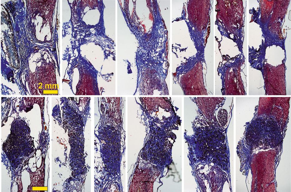 Investigadores reconectan la médula seccionada de una rata usando espumas de grafeno