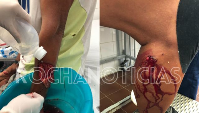 Sangre, babas y terror