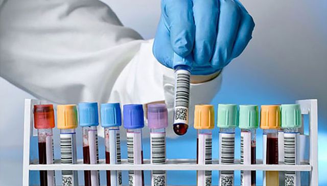 Sobre desbalances en la coagulación