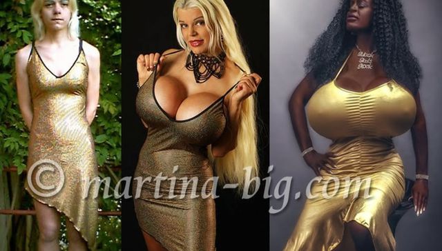 Una cuestión de piel