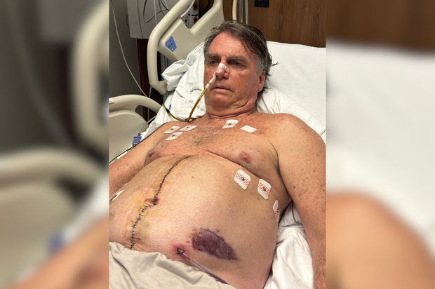 Jair Bolsonaro internado. Foto: X Jair Bolsonaro.
