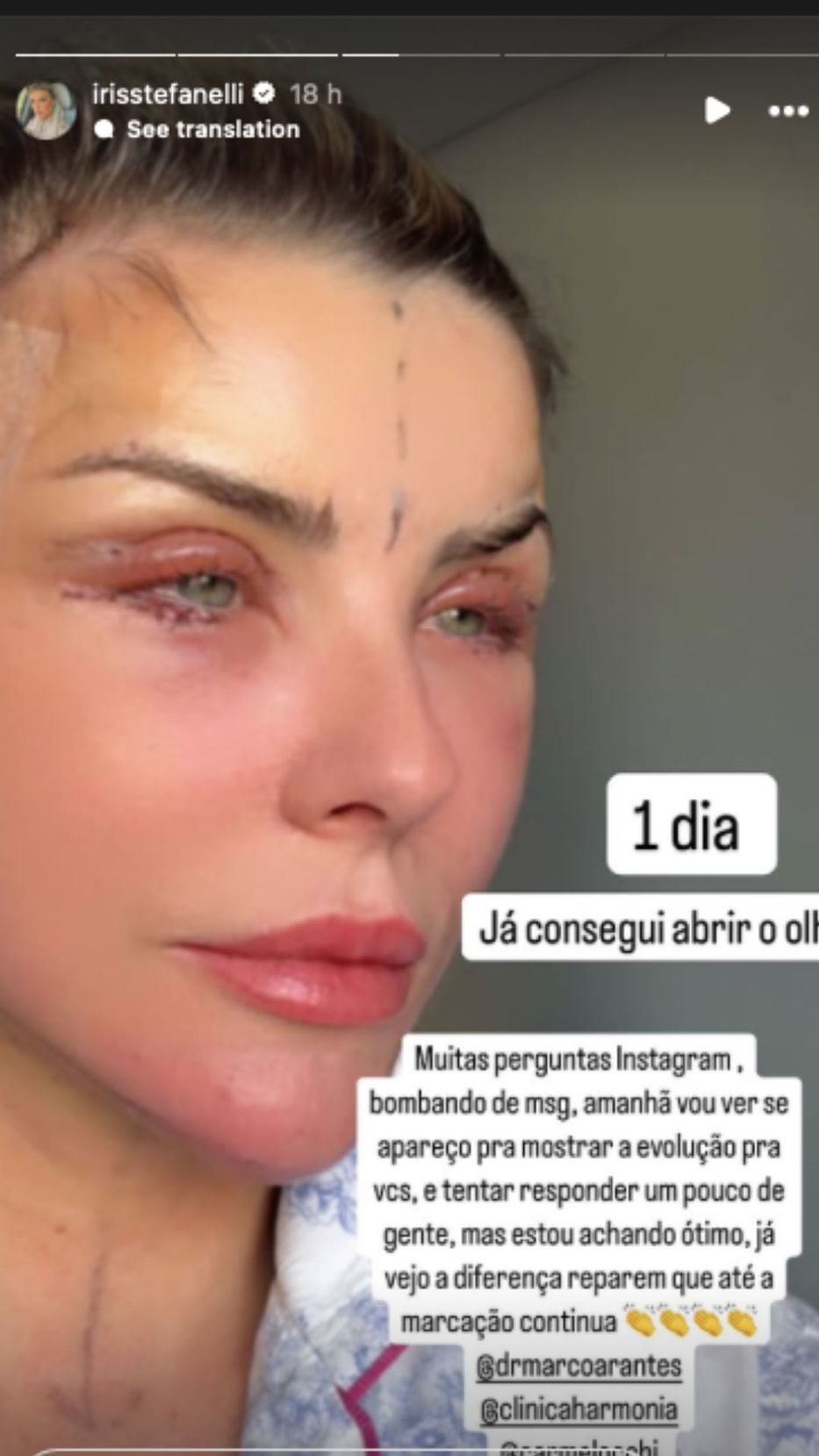 Foto:Instagram/ @irisstefanelli