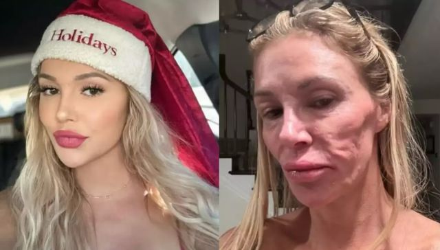 Una cuestión de piel