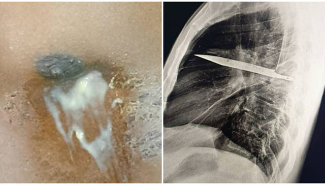 No me claves tus puñales