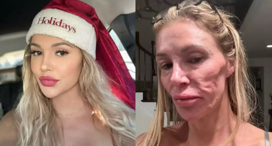 Una cuestión de piel