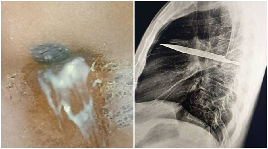 No me claves tus puñales