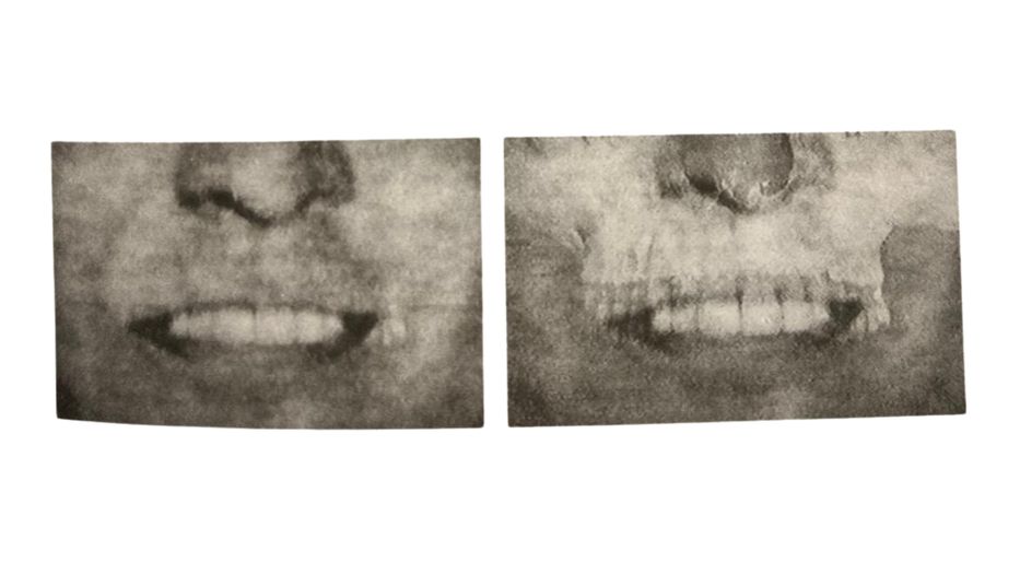 Foto: Escaneado de libro El Enigma Berríos.