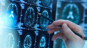 Y otras cosas que no me acuerdo