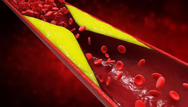 Me sube el colesterol mi mamacita