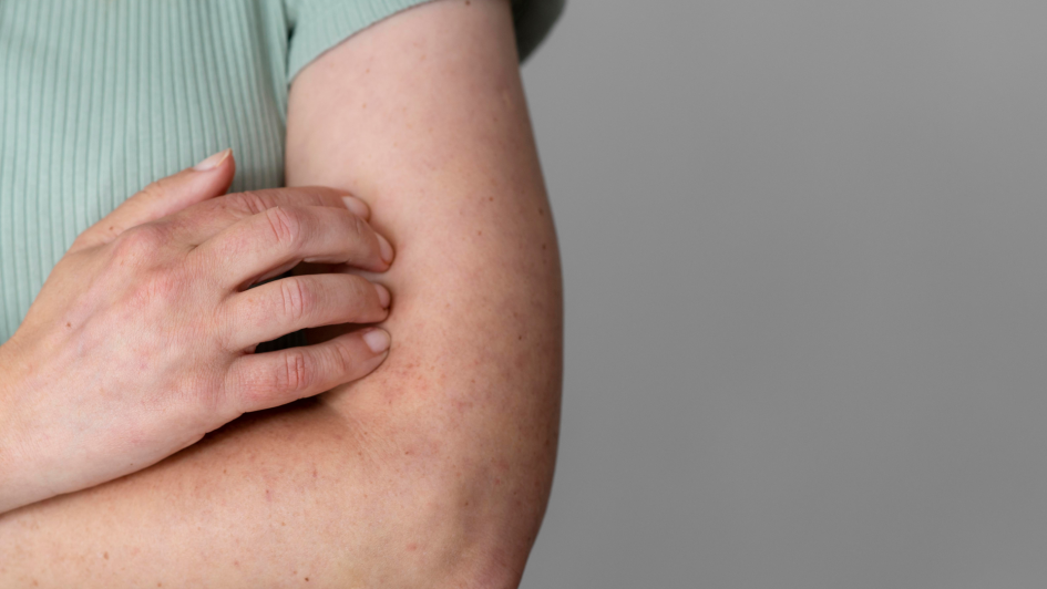 La OMS definió qué virus deben cubrir las vacunas antigripales para el hemisferio sur